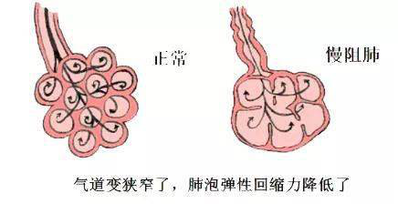 肺2.png